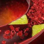 Cardiovascular Disease and Oral/ optical Health