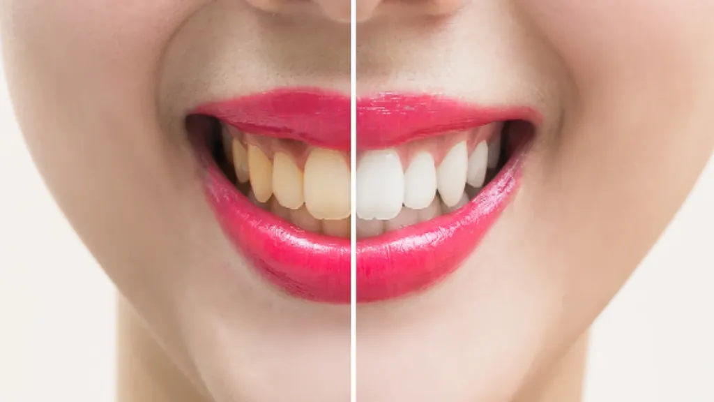 https://decare23.proactivedigital.ie/wp-content/uploads/2024/03/Blog-banner-cp-640x300-c-default.webp