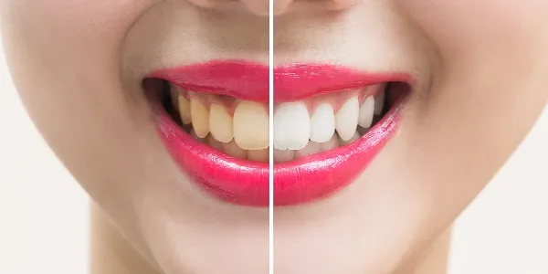 https://decare23.proactivedigital.ie/wp-content/uploads/2024/03/Blog-banner-cp.webp