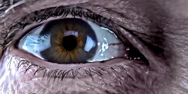 https://decare23.proactivedigital.ie/wp-content/uploads/2024/03/Cataracts-1.webp