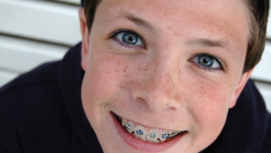 Child wearing braces