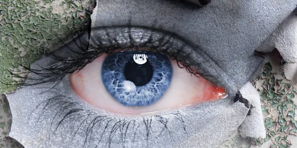 https://decare23.proactivedigital.ie/wp-content/uploads/2024/03/Dry-Eyes-1.webp
