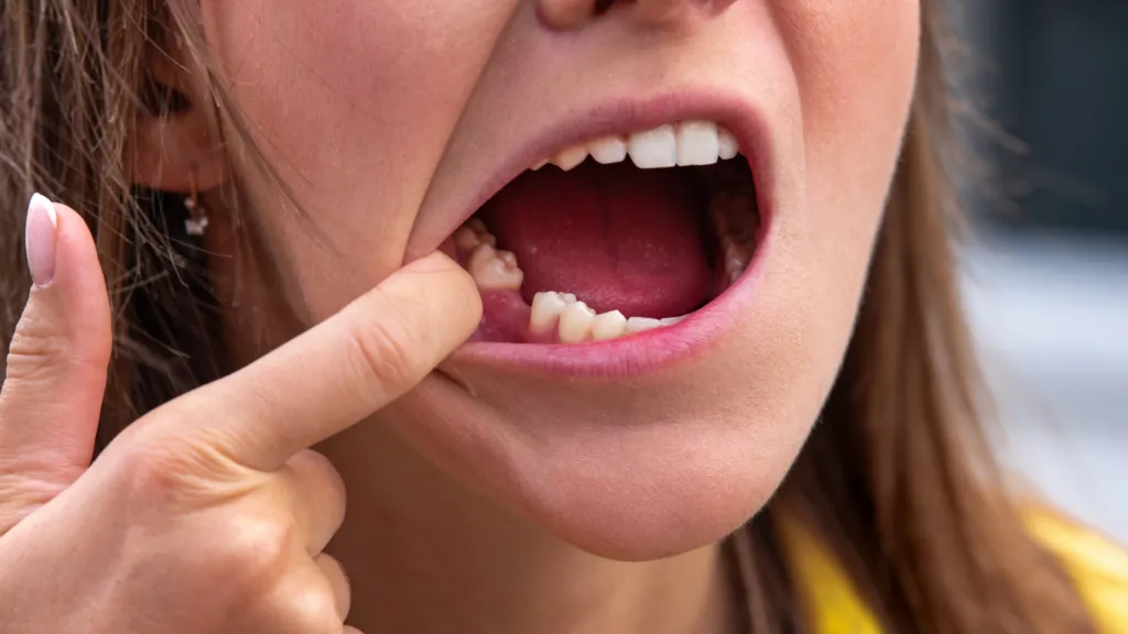 https://decare23.proactivedigital.ie/wp-content/uploads/2024/03/Tooth-Extractions-640x300-c-default.webp