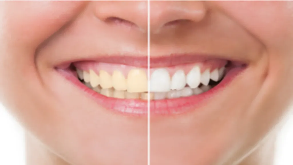 https://decare23.proactivedigital.ie/wp-content/uploads/2024/03/Tooth-Whitening-CP-640x300-c-default.webp